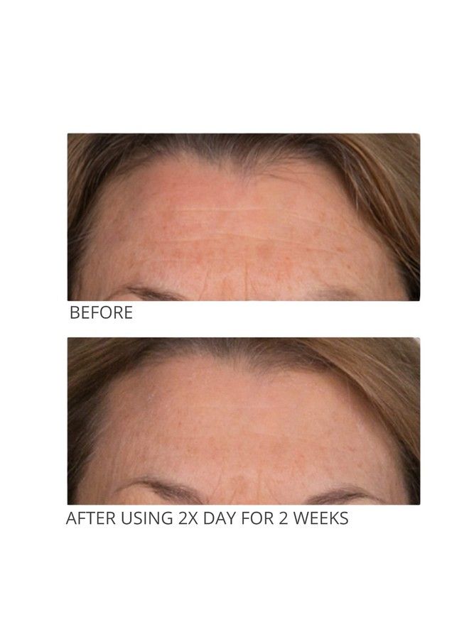 Serious C3 Plasma C Cream Vitamin C Ester Protective Daytime Broad Spectrum Spf 30 Moisturizer 2 Oz. Facial Moisture Cream Sunscreen Hydrating Smoother & Brighter Skin