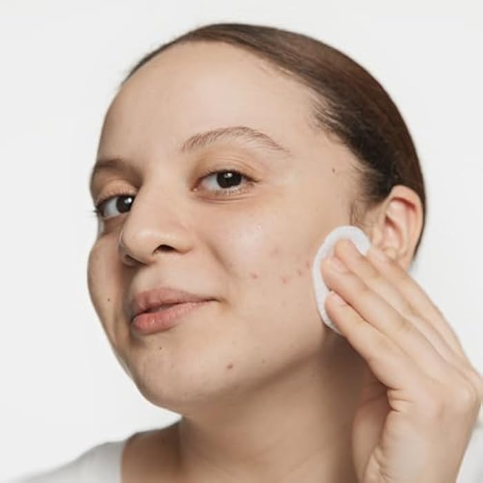 Clinique Acne Solutions Clarifying Lotion Exfoliating Facial Toner with Salicylic Acid | Reduces Oil + Unclogs Pores - Image 4