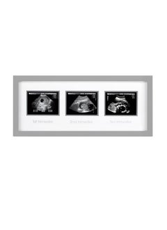 pearhead Triple Sonogram Picture Frame, Pregnancy Keepsake Photo Frame, Gender-Neutral Baby Nursery Décor, Baby Accessory for New and Expecting Parents, Gray  - Image 1