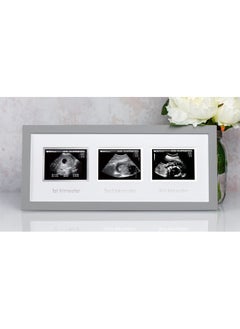pearhead Triple Sonogram Picture Frame, Pregnancy Keepsake Photo Frame, Gender-Neutral Baby Nursery Décor, Baby Accessory for New and Expecting Parents, Gray  - Image 2