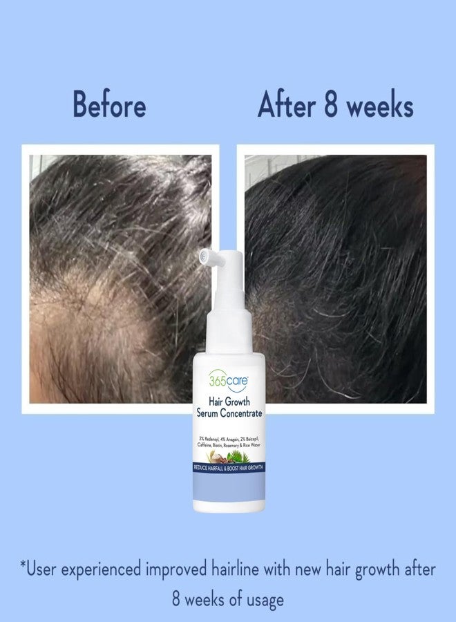 365Care Professional Hair Growth Serum - Strengthens Hair Follicles, Reduces Breakage & Hair Fall - Peptides & Pro-Vitamin B5 - 50ml - Image 3
