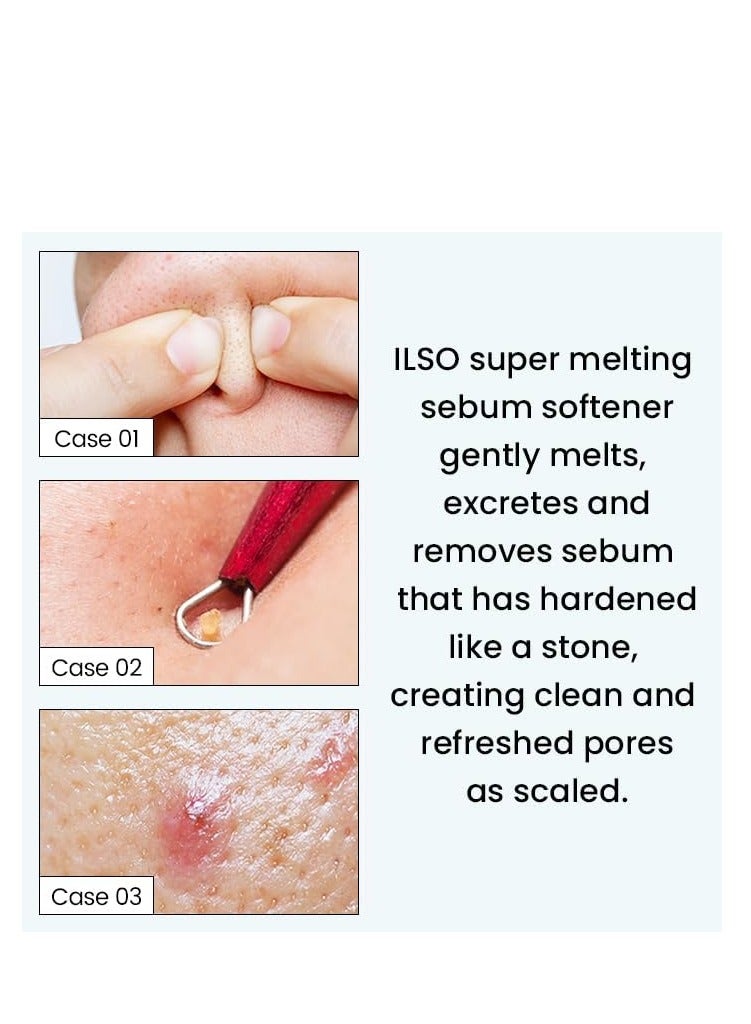 ILSO SUPER MELTING SEBUM SOFTENER - Image 5