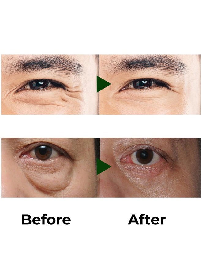 Abera Eye Roller Serum with Mint Essence, Vitamin C and Peptides - Energizing Serum for Dark Circles and Puffiness, Fine Lines Serum, 0.34 fl oz - Image 5
