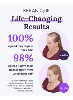 Keranique Eranique Hair Regrowth Treatment For Women 2% Minoxidil For Women Hair Growth & Thickening Topical Solution Scalp Treatment For Hair Loss & Thinning W/Precision Spray Applicator 4 Fl Oz  - Image 5