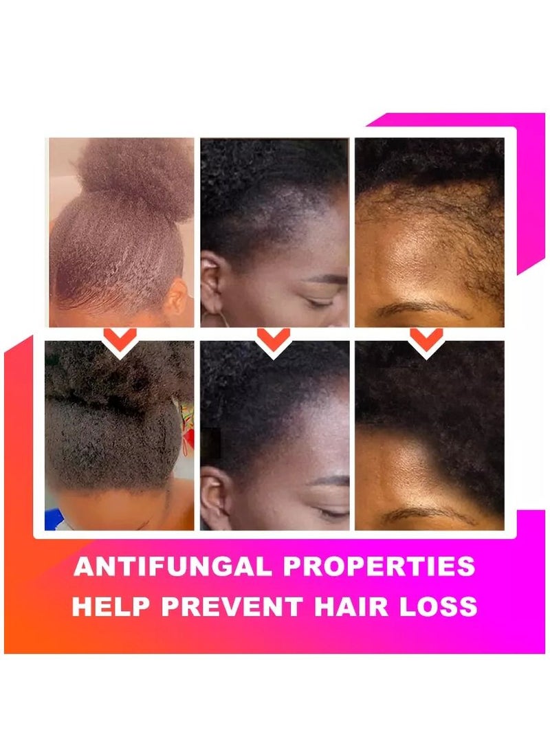 Sevich 100% Natural Chebe Hair Oil African Chebe Powder Serum Hair Loss Treatments Repair Damaged Moisture Hair Regrowth Treatments 30ml - Image 4