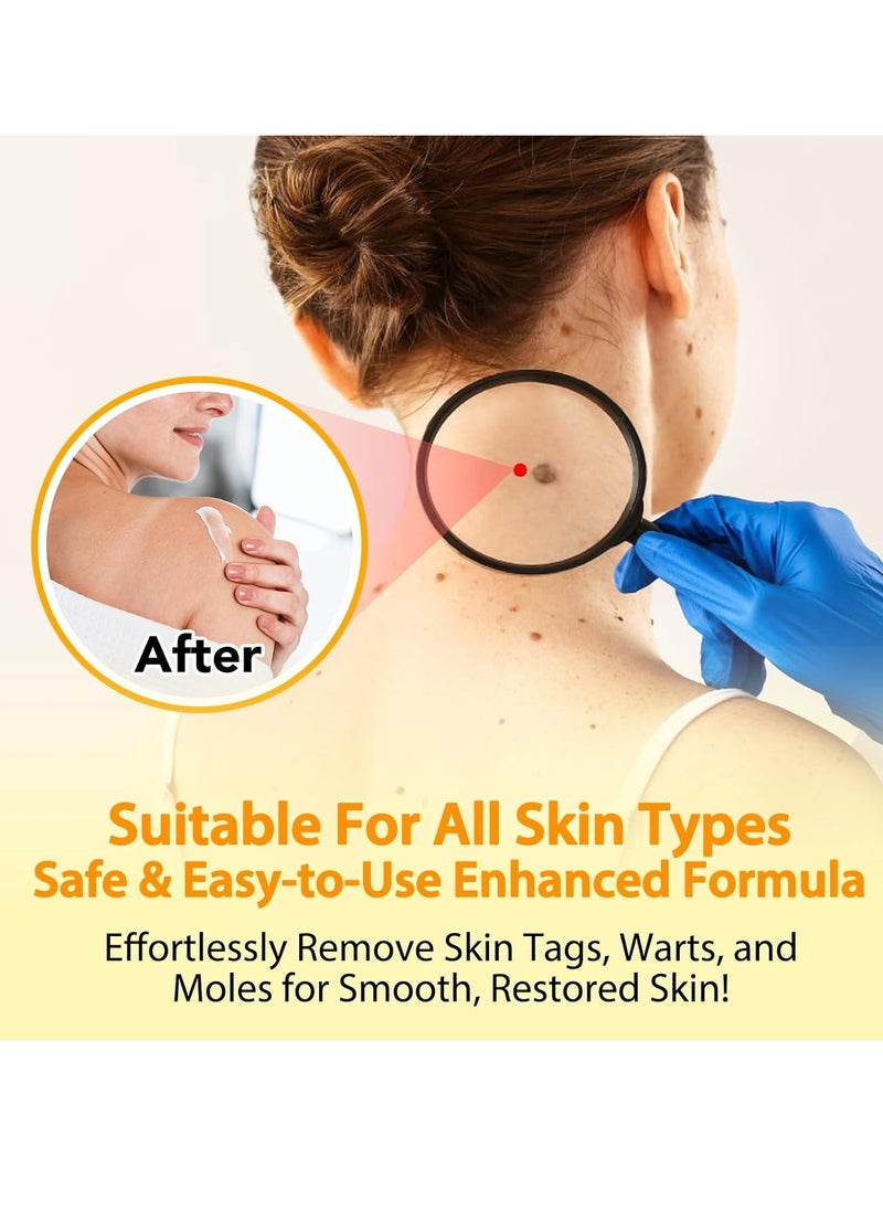 Sefudun - Bee Venom Moles and Wart Removal Cream Mole and Wart Cream Easy Application and No Irritation Wart and Tag Remover Bee Venom Repair Cream Wart Treatment Cream - Image 1