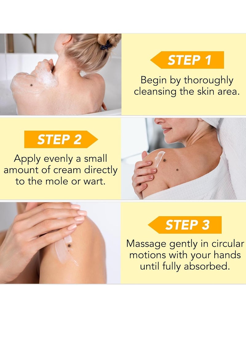Sefudun - Bee Venom Moles and Wart Removal Cream Mole and Wart Cream Easy Application and No Irritation Wart and Tag Remover Bee Venom Repair Cream Wart Treatment Cream - Image 1