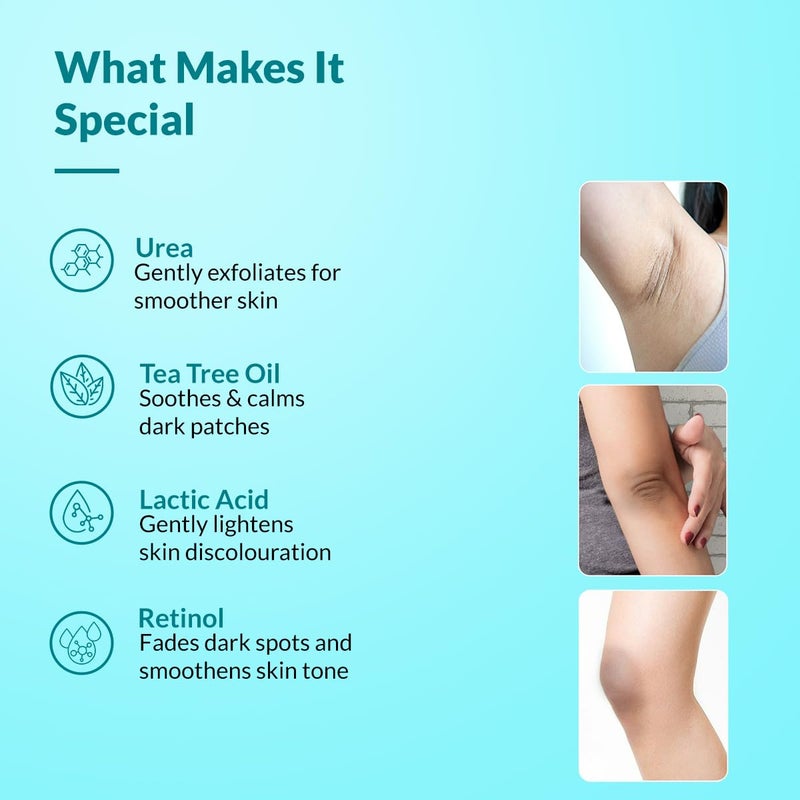 FIXDERMA كريم FIXDERMA Nigrifix لمرض الأكثوز الأسود مع حمض اللاكتيك | كريم ريتينول مختبر من قبل أطباء الجلد | مفيد للأجزاء الداكنة من الجسم مثل الرقبة والكاحلين والإبطين والمرفقين - 1.76 أونصة - Image 4
