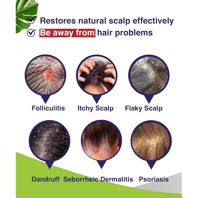PHARMBANNER 2Pcs Folliculitis, Seborrheic Dermatitis Shampoo, Anti Dandruff/Antifungal Shampoo, Scalp Psoriasis Treatment, Relieve From Itchy & Dry Scalp - Image 3