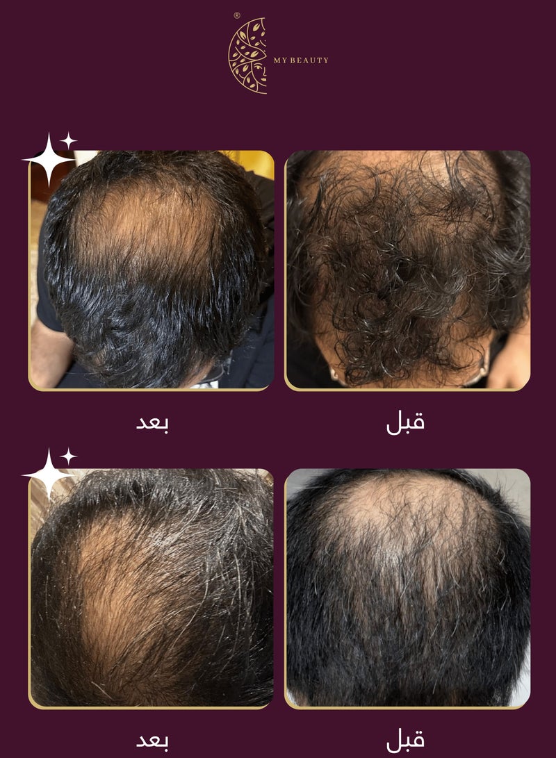 ViveLab Pack Of 3 ViveLab Revive Therapy Hair Scalp & Brow Ampoule 15*3ml - Image 5