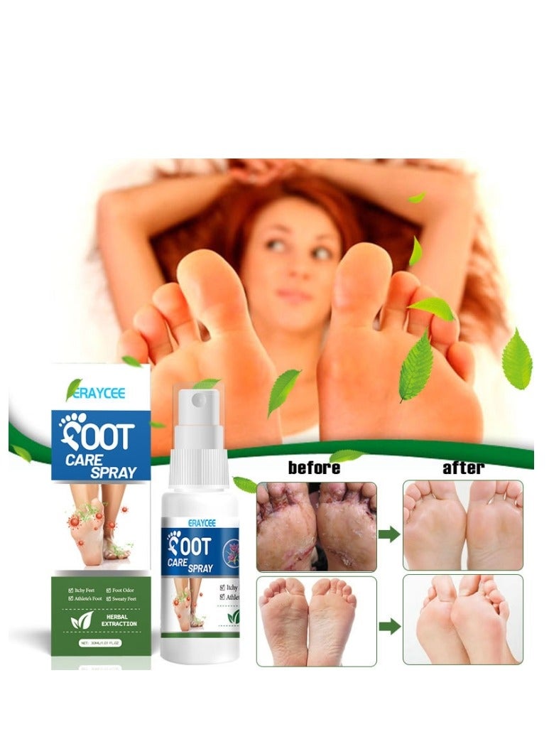 ERAYCEE Foot Deodorant Spray 30ml Foot Care Spray, Foot Odor Neutralizer, Foot Care and Hygiene, Relieves Itching, Eliminates Foot Odor, Refreshes And Invigorates, Long-Lasting Protection - Image 4