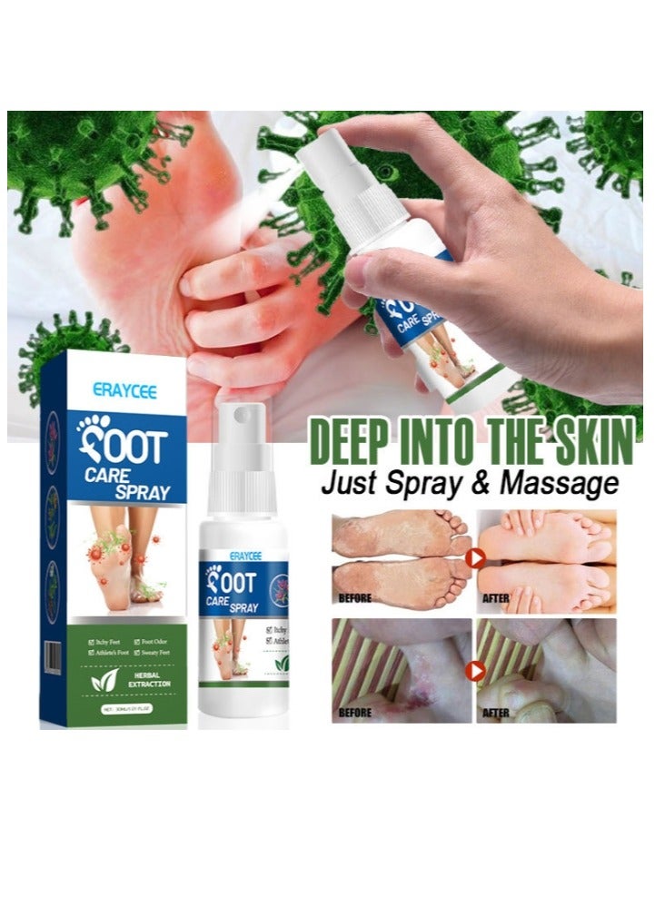 ERAYCEE Foot Deodorant Spray 30ml Foot Care Spray, Foot Odor Neutralizer, Foot Care and Hygiene, Relieves Itching, Eliminates Foot Odor, Refreshes And Invigorates, Long-Lasting Protection - Image 2