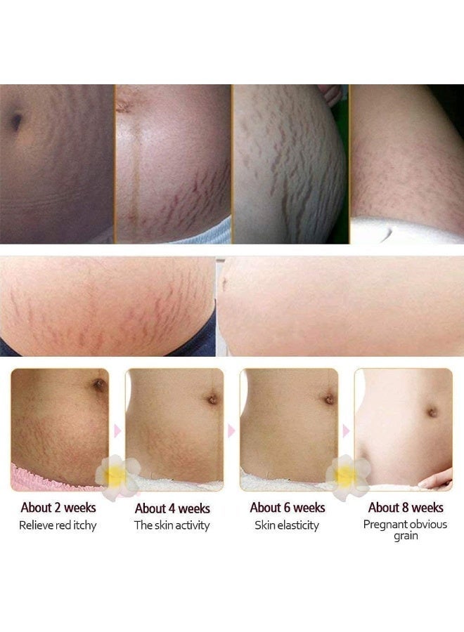 RtopR Mango Stretch Marks and Scar Cream -Stretch Marks and Scar Removal Cream for Pregnancy - Best Body Moisturizer-40g - Image 3