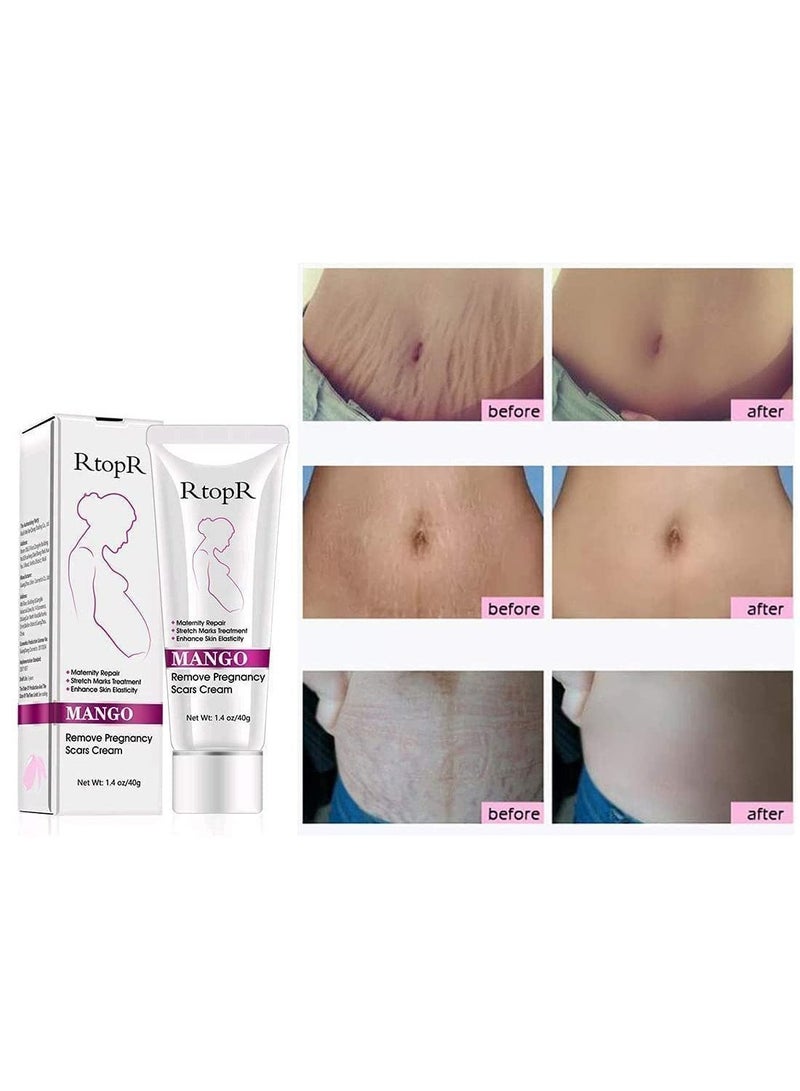 RtopR Mango Stretch Marks and Scar Cream -Stretch Marks and Scar Removal Cream for Pregnancy - Best Body Moisturizer-40g - Image 2