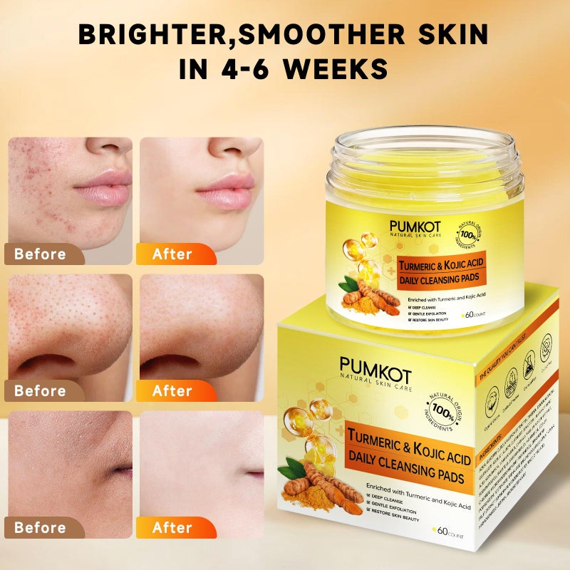 Pumkot Turmeric Kojic Acid Cleansing Pads, Turmeric Face Scrub Pads Enriched with Kojic Acid, 60PCS - Image 4