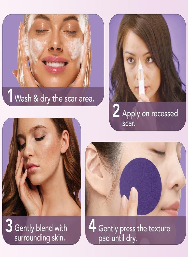 Dermaflage Scar Filler Kit - Medium - Deep Scar Cover and Waterproof Concealer for Acne Scars Wrinkles, and Ice Pick Scars Makeup, 1 mo supply - Image 5