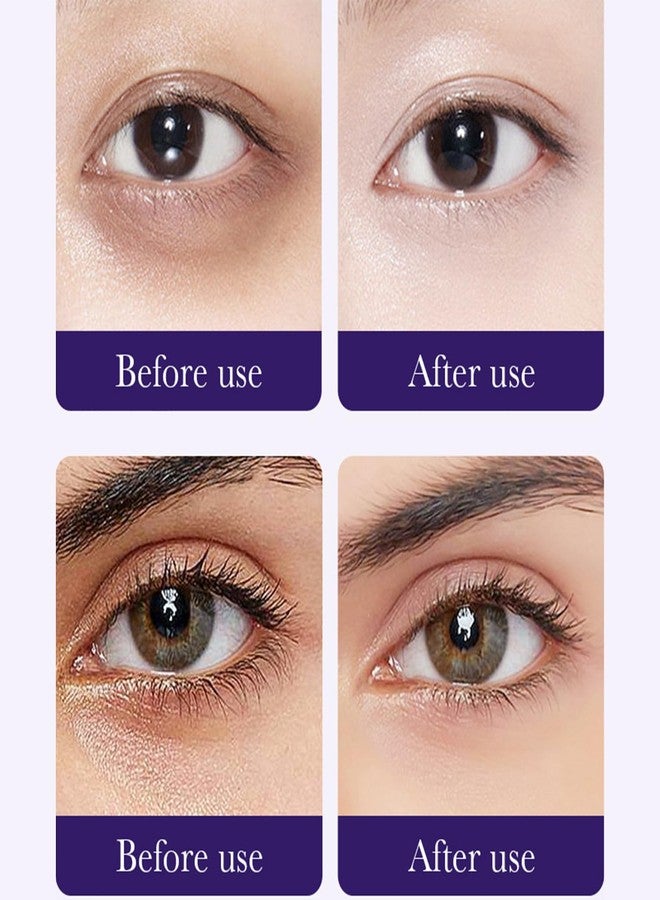 Eakroo Grape Eye Mask, 60 PCS Eye Patches for Puffy Eyes and Dark Circles, Eye Masks for Dark Circles and Puffiness, Undereye Mask Patches, Under Eye Bags, Eye Mask Skincare, Improve Eye Skin - Image 5