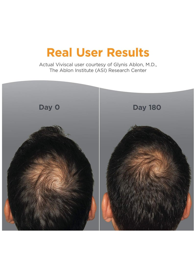 Viviscal - Man Hair Health Supplements, 180 Tablets - Image 1