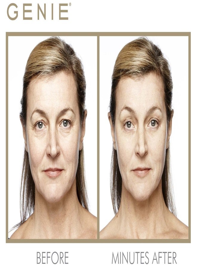 جيني لتنعيم الخطوط الفورية (30 مل/1 أونصة سائلة) - Image 4