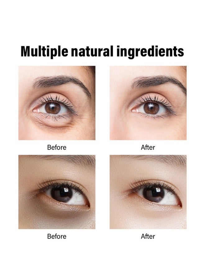 Generic Retinol Repair Eye Cream, Daily Wrinkle Cream, Anti-Aging Eye Cream with Retinol to Reduces Fine Lines, Dark Circles, Eye Bags & Puffiness and Brighten Skin, 1.5 oz (1PCS)  - Image 4
