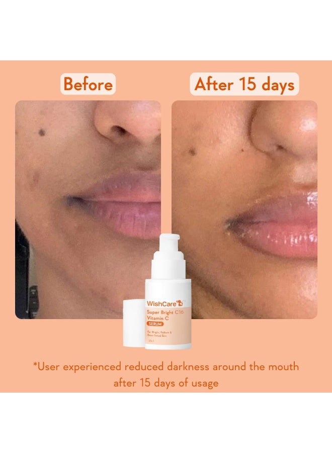سيروم فيتامين سي لتفتيح البشرة - Image 4
