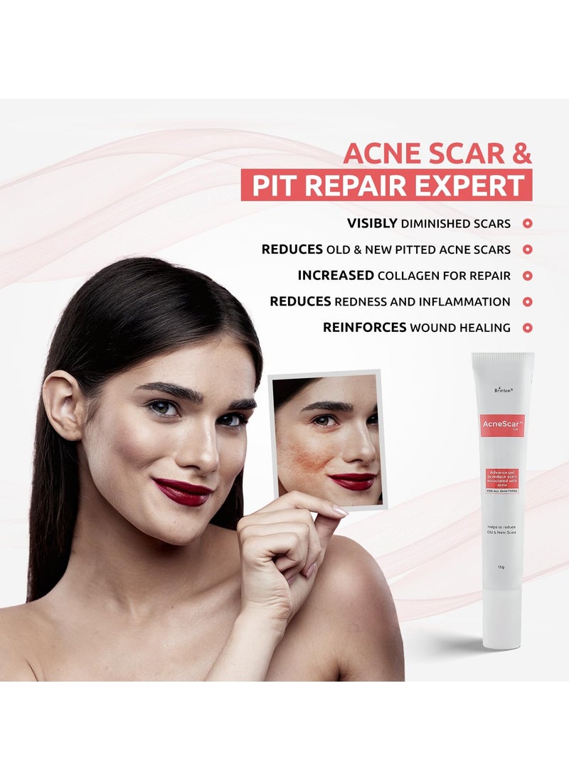 Brinton AcneScar Advanced Gel to Reduce Acne Scars & Pits, White, 15 g - pzsku/ZBA458267A22AC9608CA2Z/45/_/1736162741/d6ba2869-8670-405f-b96f-1bcad618aa4f