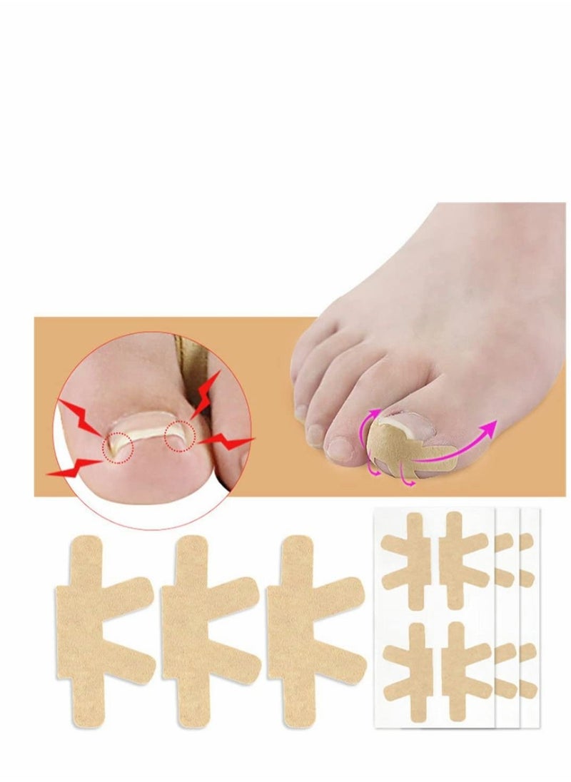 Generic - Ingrown Toenail Correction Stickers, Glue-free Ingrown Toenail Corrector Strips, Painless Pedicure Toenail Corrector Patch Professional Toenail Treatment Tool Foot Care(60 PCS) - Image 1