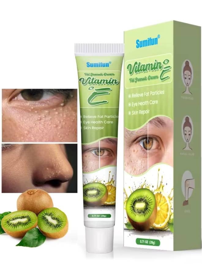 سوميفون كريم حبيبات الدهون بفيتامين E يشد ويصلح البشرة حول العينين، يدعم صحة العين، يزيل جزيئات الدهون بفعالية، حبيبات للعناية الخاصة بالعين، كريم العناية تحت العين 20 جرام - Image 1