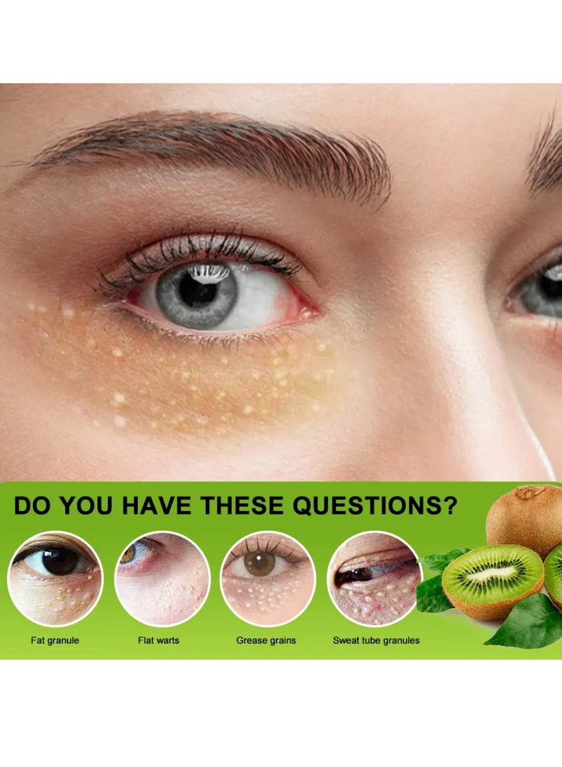 سوميفون كريم حبيبات الدهون بفيتامين E يشد ويصلح البشرة حول العينين، يدعم صحة العين، يزيل جزيئات الدهون بفعالية، حبيبات للعناية الخاصة بالعين، كريم العناية تحت العين 20 جرام - Image 5