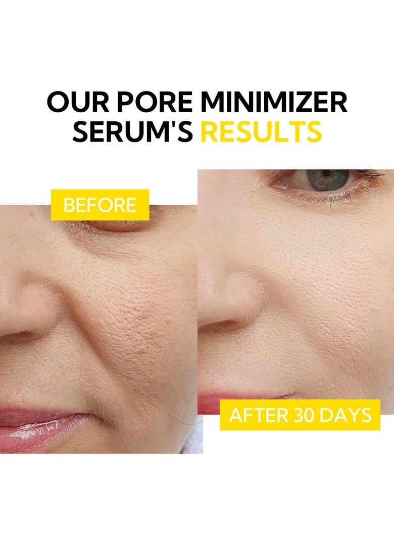 Pore Minimizer Serum, Pore Minimizer & Reducer for Face, Minimizing, Shrinking, Oil Control Firming, Tightening Pores, 100% Vegan Pore Moisture after Blackhead Remover, 0.5 fl.oz