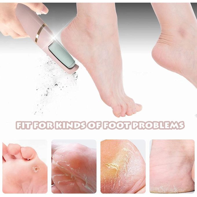 Electric pedicure device for foot care, double-headed foot file, callus and dead skin remover, foot scrubber and foot care device - Image 4