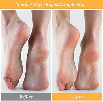 Aster 3 Pairs Moisturizing Socks Overnight Lotion Socks for Dry Feet Cotton Moisture Enhancing Socks Spa Socks for Cracked Heel Repair Cosmetic Moisturizing Socks for Women and Men White - Image 5