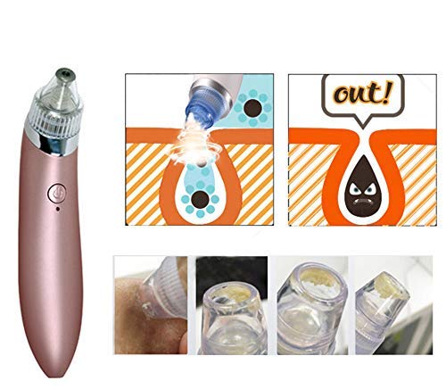 RK enterprise Cleaner Vacuum Beauty Facial Skin Care Blackhead Remover Rose Red - Image 5