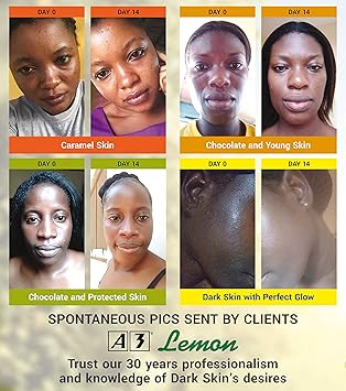 A3 Lemon Lotion 4EVER BRIGHT 400 ml - Image 5