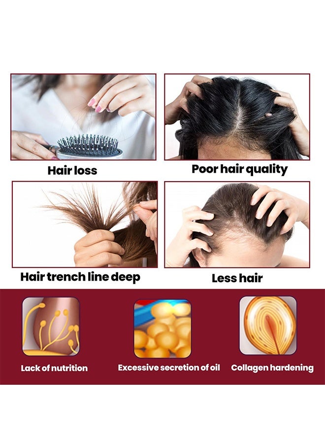 EELHOE Hair Regeneration Foam,  Revivies And Restores Hair Follicles For Women Hair Health Care Four Month Supply 60g - Image 3