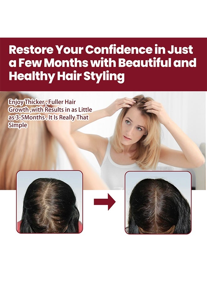 EELHOE Hair Regeneration Foam,  Revivies And Restores Hair Follicles For Women Hair Health Care Four Month Supply 60g - Image 4