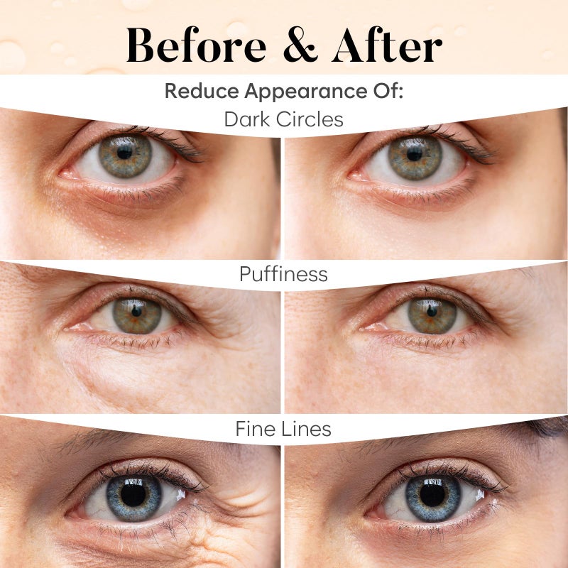 BLOOMORA Caffeine Under Eye Patches (30 Pairs), Under Eye Mask for Puffy Eyes, Appearance of Dark Circles, Cooling & Hydration, Self Care & Skincare Gifts for Women, Patch Yeux - Image 4
