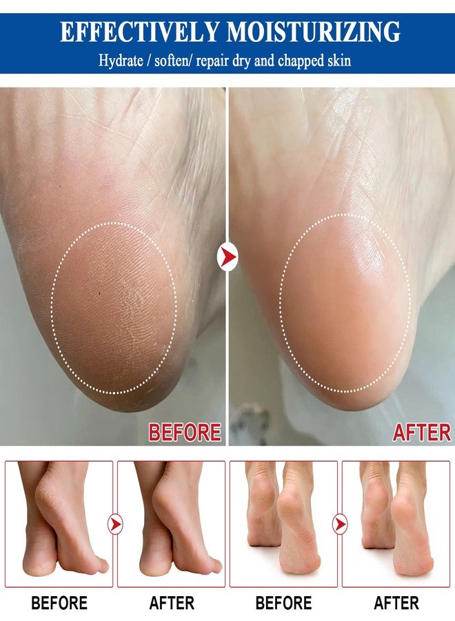 teerova Urea Cream 60% plus Salicylic Acid 2%, Urea Foot Cream Stick Balm, Maximum Strength Moisturizer for Dry Cracked Heels Thicken Skin, Soften Smoothing Foot Exfoliate Dead Skin, 40g - Image 4