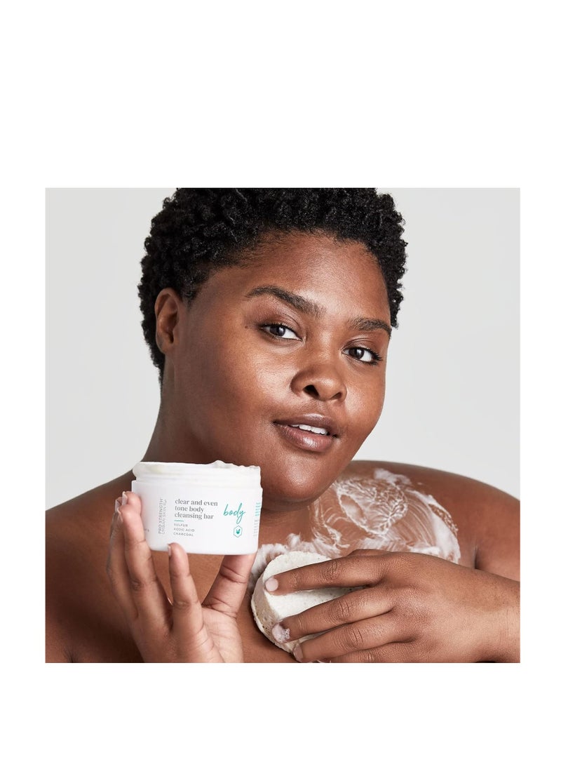 Urban Skin Rx - Urban Skin Rx Clear and Even Tone Body Cleansing Bar | Smoothing + Clarifying Cleanser + Improves Appearance of Uneven Skin Tone + Blemishes, Use on Back, Shoulders, & Chest | 5 Oz - Image 1
