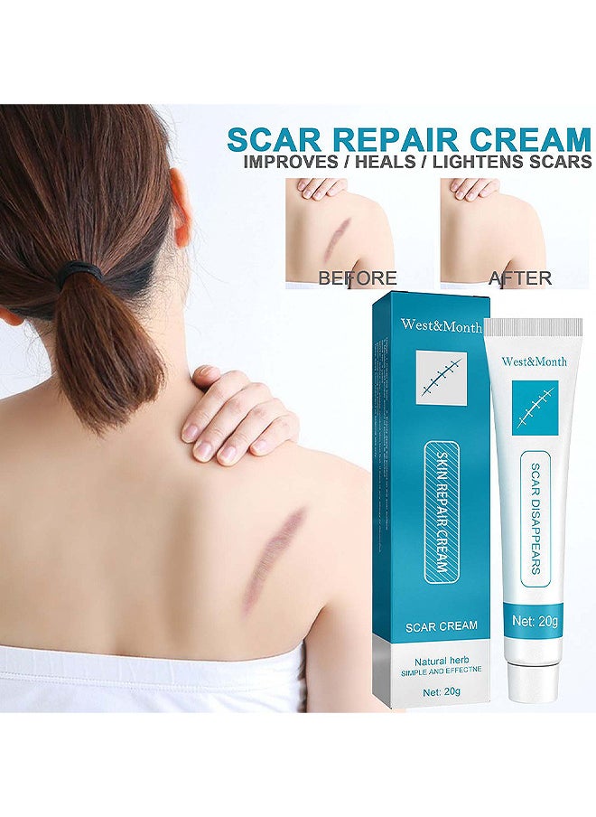 West&Month Scar Repair Cream Dilute Hyperplasia Pregnancy Surgery Burn Scald Skin Repair Scar Cream 20G  - Image 1
