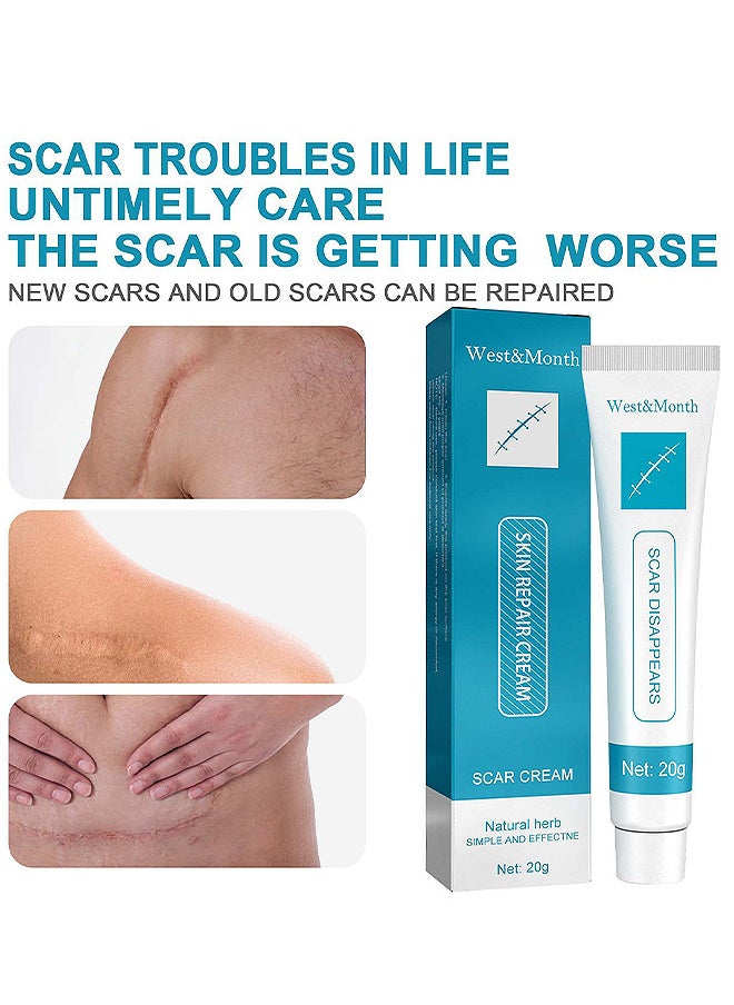 West&Month Scar Repair Cream Dilute Hyperplasia Pregnancy Surgery Burn Scald Skin Repair Scar Cream 20G  - Image 4