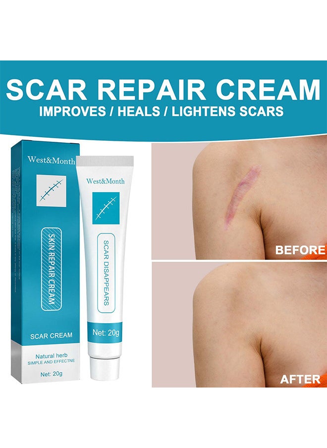 West&Month Scar Repair Cream Dilute Hyperplasia Pregnancy Surgery Burn Scald Skin Repair Scar Cream 20G  - Image 3