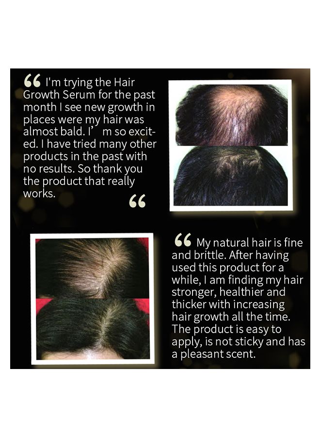 لانثوم زيت بذور الحبة السوداء لنمو الشعر 30 مل - Image 4