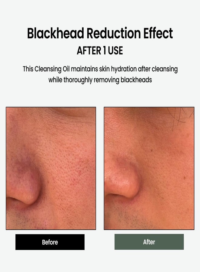 delphyr Liposome Daily Cleansing Oil, Gentle Makeup & Blackhead Remover for Sensitive Skin with Centella Asiatica TECA, Korean Skincare for Trouble Care (6.76 fl. oz., 200ml) - Image 4