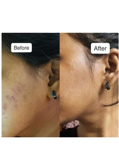 vilvah STORE Vilvah Store Milk Drops Brightening Serum Formulated With Rice Milk Extract Marine Algae Extract Alpha Arbutin  Fades Scars Brightens Skin And Even  - Image 4