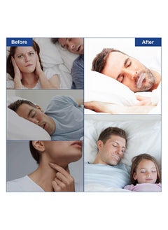 Elaimei Sleep Strips ,Snore Less ,Sleep Better,Live Happier, Advanced Gentle Mouth Tape for Nose Breathing, Nighttime Sleeping, Mouth Breathing, and Loud Snoring - Pack of 90 pieces  - Image 2