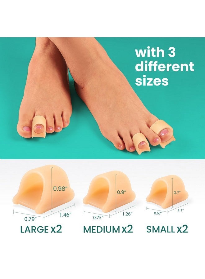 Welnove Hammertoe Corrector - 6 Pack Toe Splints - Soft Gel Toe Straighteners - Realign Bent, Curled, Crooked, Claw, Hammer Toes - Toe Corrector For Men And Women, 3 Different Sizes (Beige)  - Image 2