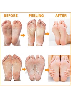 MBeauty Exfoliating Magic Foot Socks, Single Use 1 Pair Moisturizing Socks, Softens & Removes Dead Calluses, Infused With Natural Ingredients, For Soft & Refreshed Foot (Pack of 1)  - Image 3