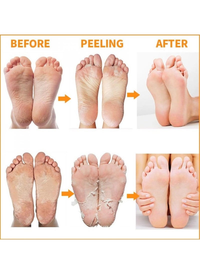 MBeauty - Exfoliating Magic Foot Socks, Single Use 1 Pair Moisturizing Socks, Softens & Removes Dead Calluses, Infused With Natural Ingredients, For Soft & Refreshed Foot (Pack of 1) - Image 1