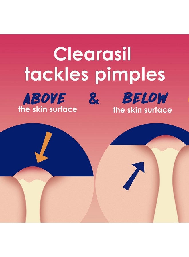 Clearasil مناديل علاج حب الشباب العميقة من ليراسيل رابيد ريسكيو، قوة قصوى، تحتوي على 2% حمض الساليسيليك، 90 قطعة - Image 4